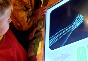 Na zdjęciu dzieci wykonujące rentgen ręki.